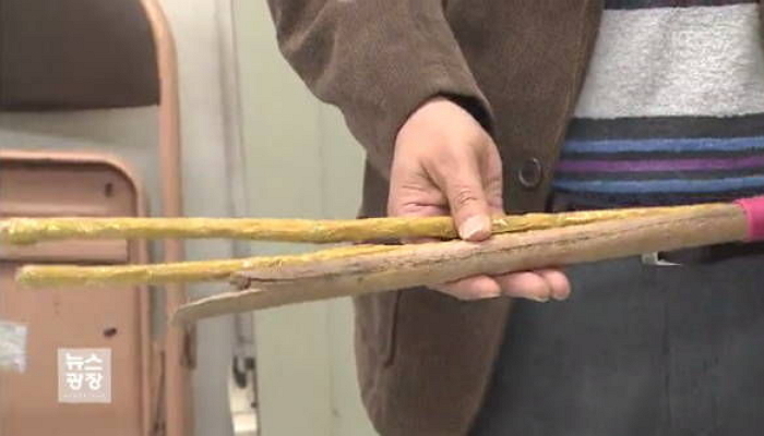 숙제 안했다고 몽둥이로 500대 맞아 피멍든 고교생