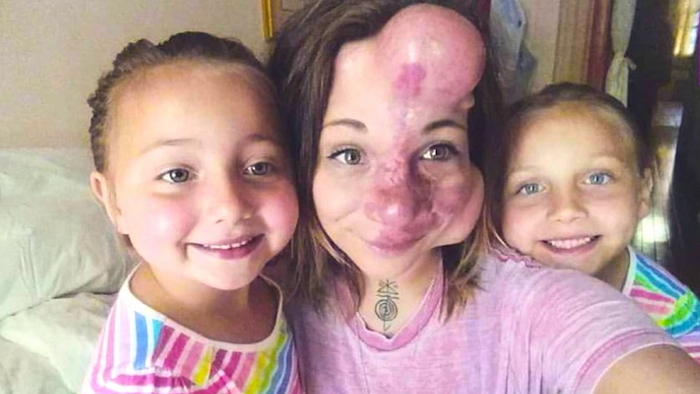 “엄마 얼굴이 어떻든, 우린 엄마를 사랑해요”