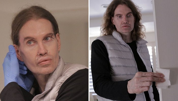 ‘결벽증’ 때문에 여성과의 성관계도 거부하는 남성