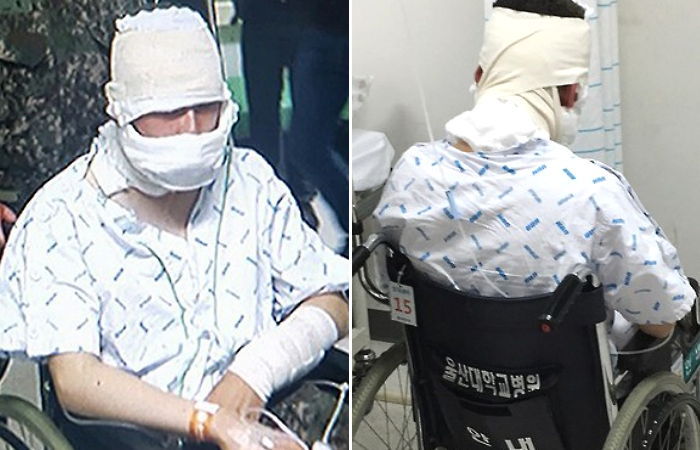 울산 ‘군부대 폭발’ 사고로 얼굴에 붕대 감은 화상 군인