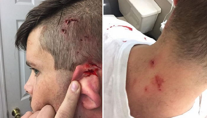 고양이 놀리면서 크리스마스 선물 개봉한 집사의 최후 (영상)