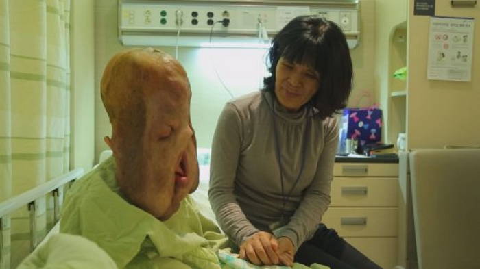 ‘신경섬유종’ 현희 씨, 1kg 혹 제거수술 무사히 마친 근황 공개