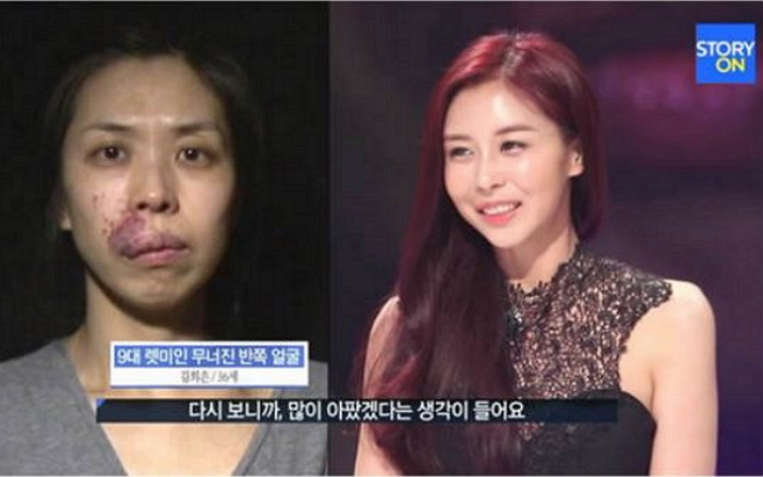 인사이트