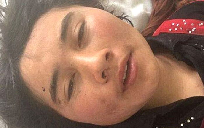 다른 남자와 대화했다고 남편에게 ‘두 귀’ 잘린 아내