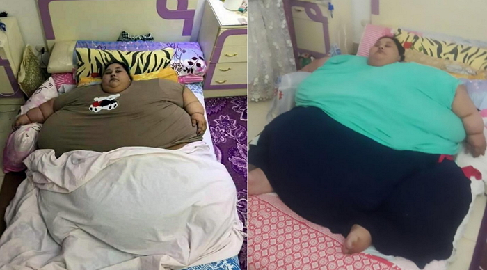 세계서 가장 뚱뚱한 ‘500kg’ 여성, 화물기로 병원행