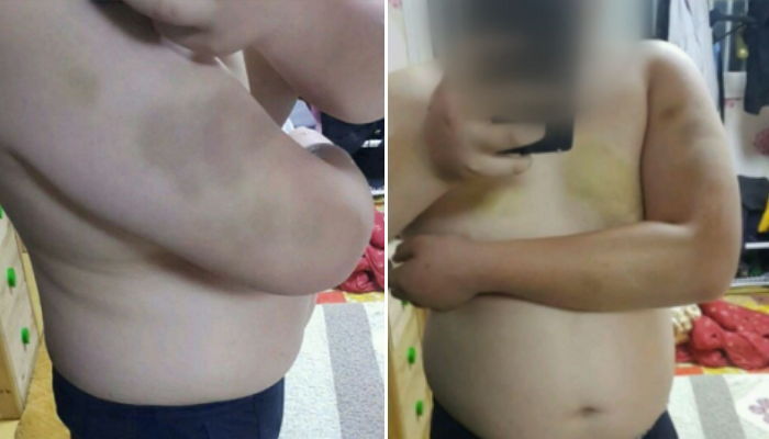 친구 방에 가두고 흉기로 찌르며 수차례 폭행한 남중생들