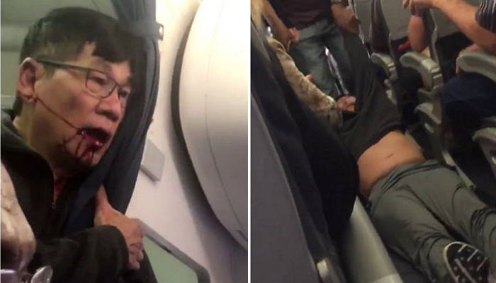 유나이티드서 강제로 끌려나와 피범벅된 승객 신상정보 턴 외신