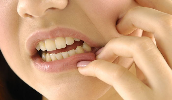 치아 건강 위해 치과의사들이 하지 않는 습관 4가지