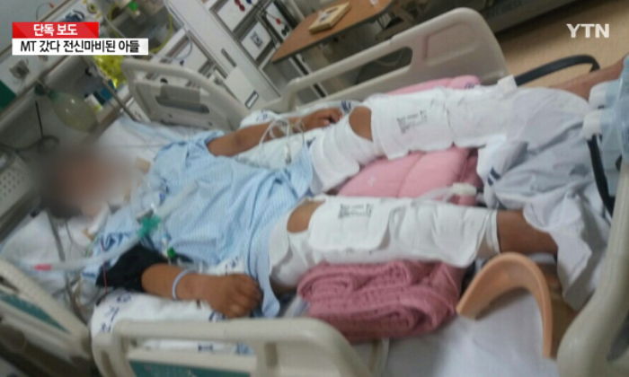 “학과MT 갔던 아들이 ‘전신마비’가 되어 돌아왔습니다”