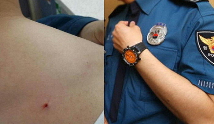 중학생에게 ‘샤프 테러’ 당한 경찰이 마음의 상처가 컸던 이유