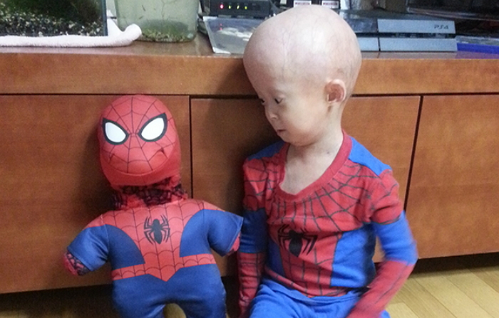 조로병 앓는 원기,“ 한국 오는 스파이더맨 배우들 만나고 싶어요”