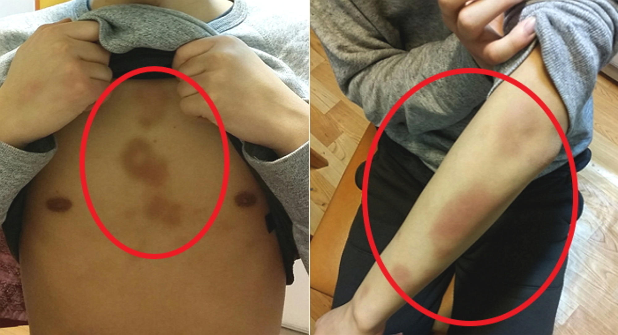 절친에게 집단 폭행·구강성교 당한 뒤 '지옥'서 사는 남학생 - 인사이트 절친에게 집단 폭행·구강성교 당한 뒤 '지옥'서 사는 남학생 - 인사이트