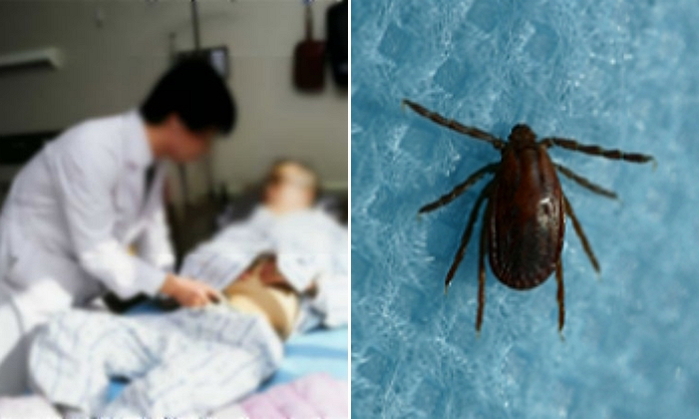 “올해 7월까지 ‘흡혈 진드기’에 물려 ‘13명’ 사망했다”