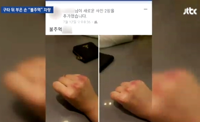 폭행 후 부은 손을 ‘불주먹’이라며 SNS에 올린 은평 여중생 폭행 가해자