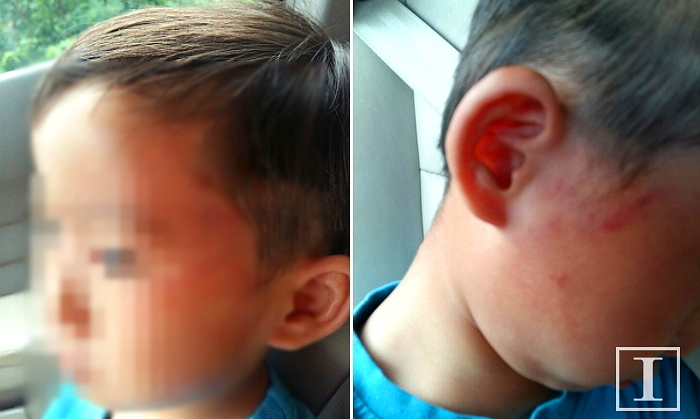 3살 원생 뺨 때리고 폭행한 ‘원장 수녀’ 입건