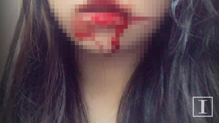 “전 남친에게 5개월간 상습 폭행과 살해 협박을 당했습니다”