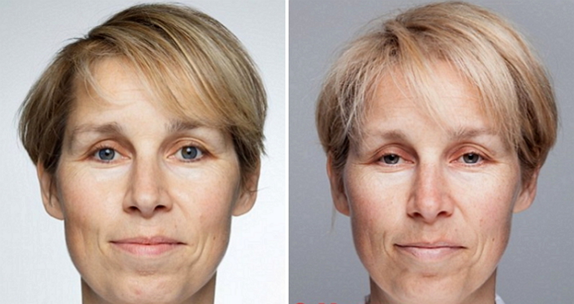 Данного другого с возрастом. Женщина до и после курения. Лицо курильщика до и после. Алкаголичное лицо женщины.