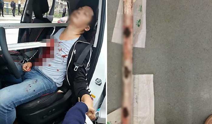 교통사고로 가슴에 ‘철근’ 관통 당하고도 ‘기적’처럼 살아남은 남성