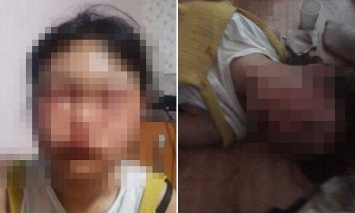 강릉 또래 집단폭행한 10대 가해자 6명 전원, 처벌 대신 ‘보호처분’ 받았다