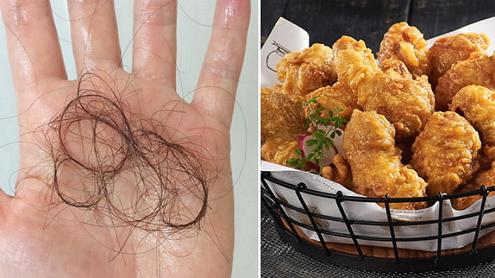 “허니콤보서 머리카락 나와도 할말 없다”···교촌치킨 가맹점, 위생관리 미준수 논란