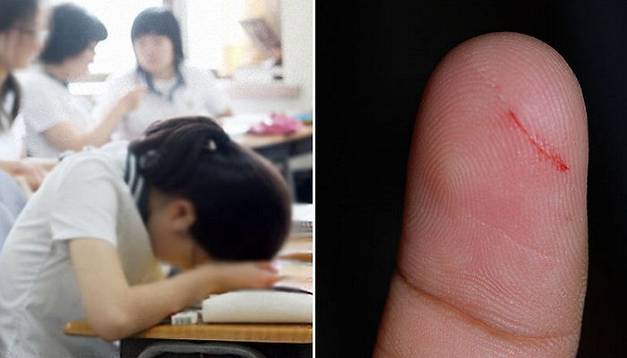 ‘종이’에 손가락 베이면 톱에 썰린 것처럼 고통스러운 이유