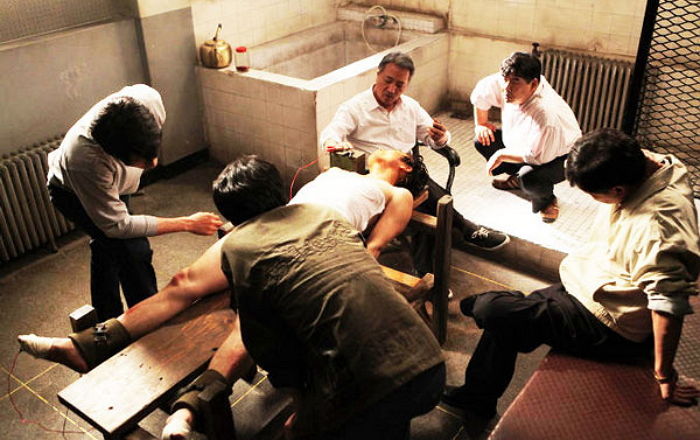 31년 전 故 박종철처럼 ‘남영동’서 고문당한 피해자들 몸에 남은 참혹한 상처