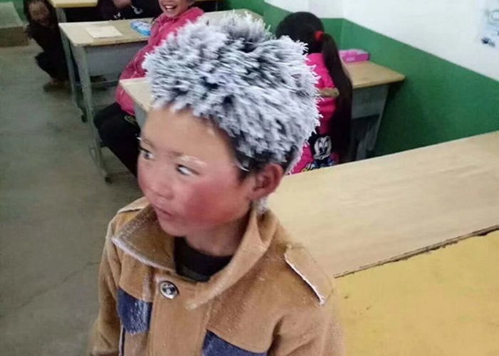 13억 온정 모였는데 고작 ‘130만원’ 받은 中 소년, 한국에도 눈송이 소년은 있다