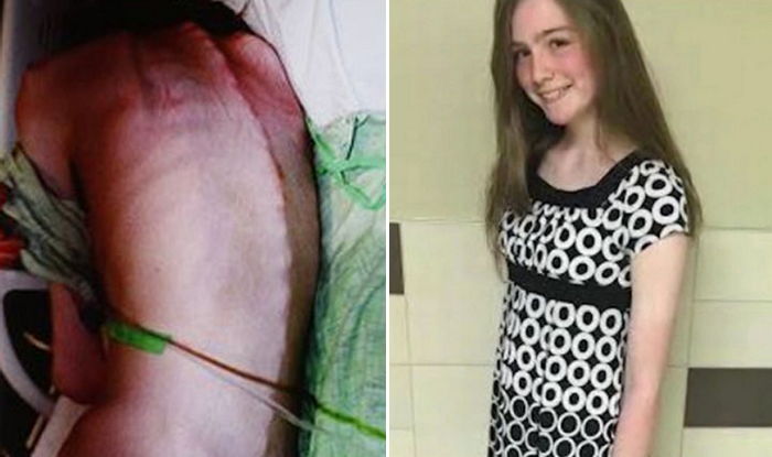 새엄마 학대로 물 한 모금 먹지 못한 소녀의 앙상한 뒷모습