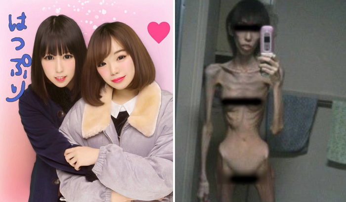 10년 전 학대로 체중 16kg 나간 소녀가 최근 모습을 공개했다