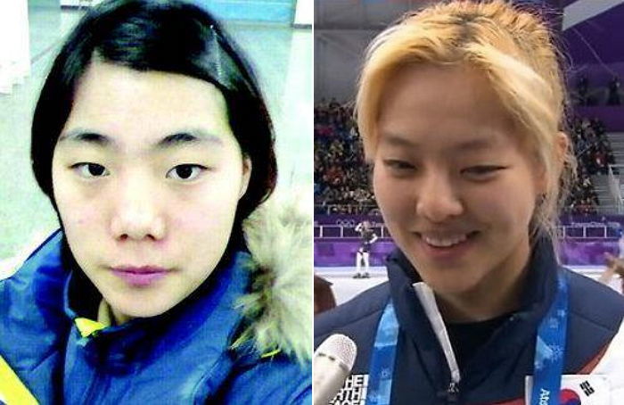 김보름 인터뷰 ‘옹호’했다가 비난 여론 일자 바로 사과한 장수지 선수
