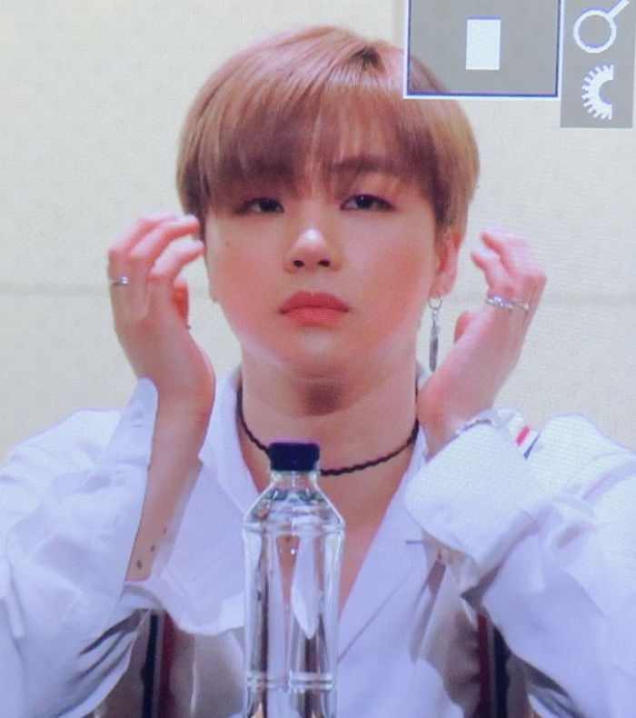 사랑니 뽑고 ‘다람쥐’처럼 볼 빵빵 부은 아이콘 김진환