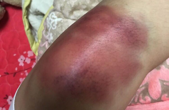 “시퍼런 무릎”…‘똥군기’에 멍든 홍익대학교 응원단 아사달