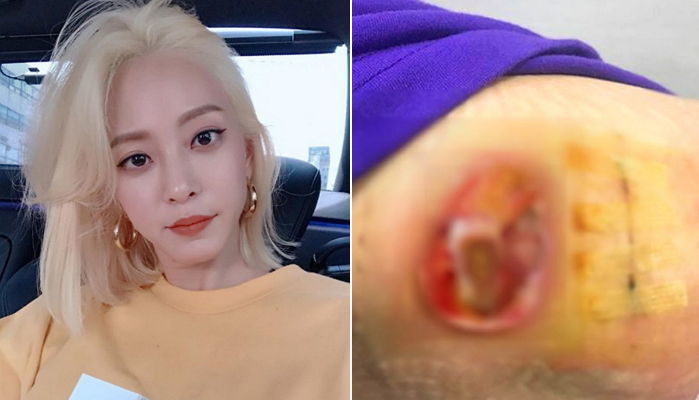 한예슬 집도의 의료사고 인정 “죄송하게 생각…사과드린다”