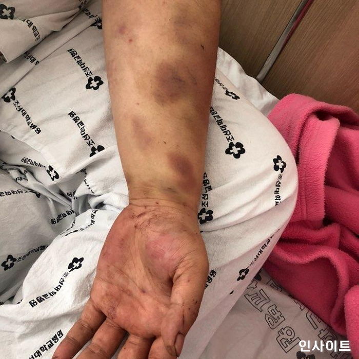 “광주 집단폭행으로 ‘실명위기’ 처한 피해자, ‘피의자’ 될수 있다”