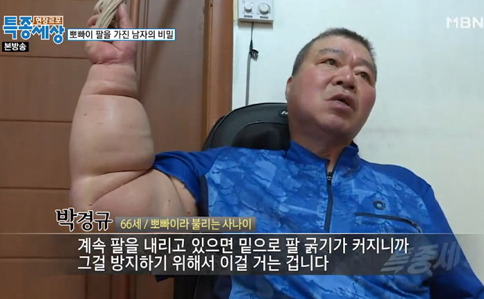 풍선처럼 부풀어오른 팔 ‘평생’ 묶어놓고 살아야 하는 ‘뽀빠이’ 아저씨
