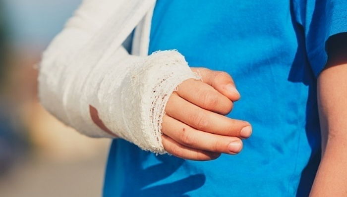 초등학교 6학년 소녀가 학교 계단에서 ‘일부러’ 넘어진 사연