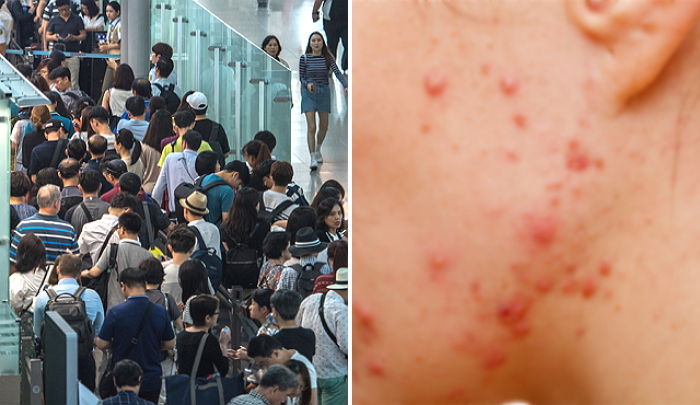 한국인 즐겨찾는 ‘일본 오키나와’서 전염병 ‘홍역’ 유행