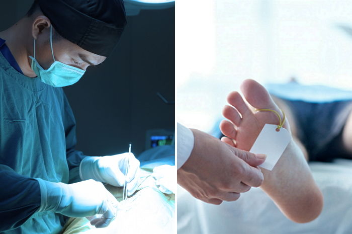 정맥 아닌 동맥에 ‘관’ 삽입해 환자 ‘숨지게’ 한 레지던트