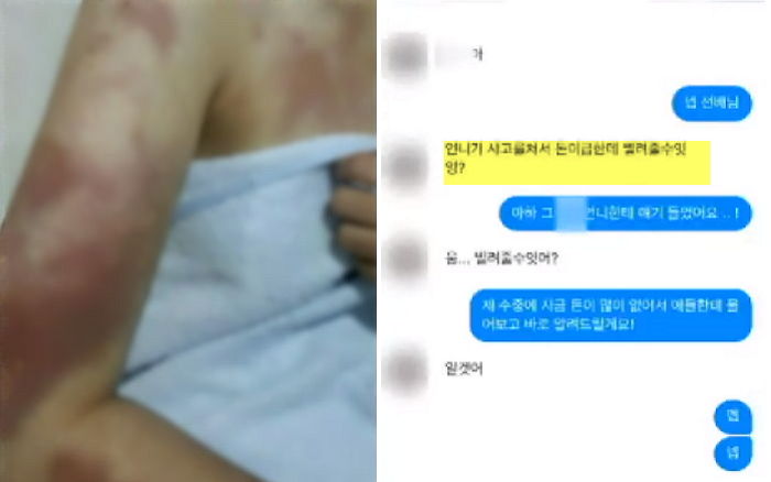 “합의금 필요하다”며 다른 학생들에 ‘3만원’씩 돈 뜯은 관악산 폭행 가해자들