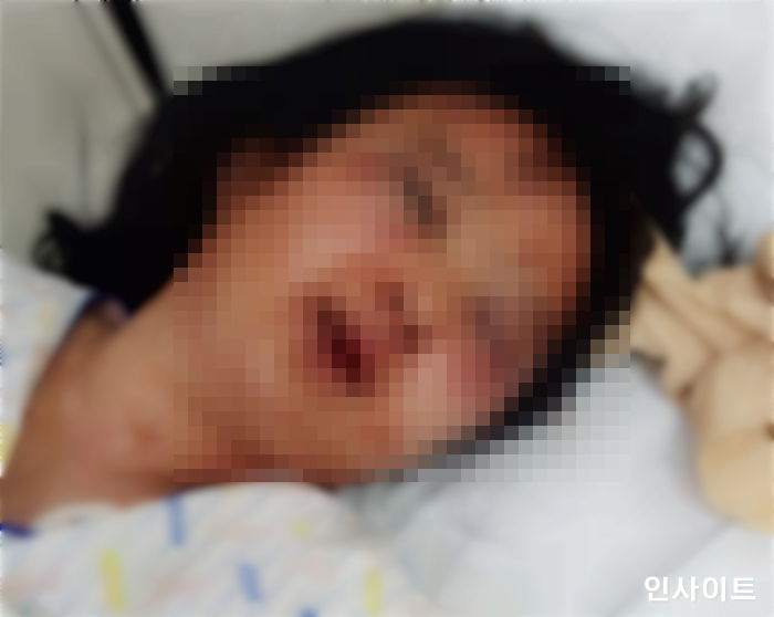 [단독] 한달 사귄 연하 남자친구 ‘데이트폭력’에 얼굴 피투성이된 20대 여성