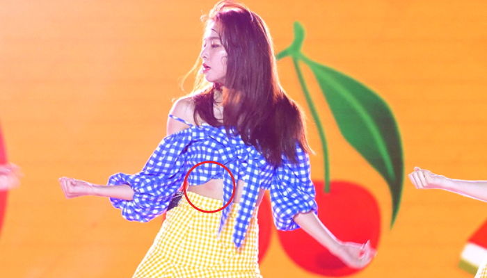 ‘모기’가 물고 도망간 ‘배’ 너무 가려워 박박 긁은 레드벨벳 슬기