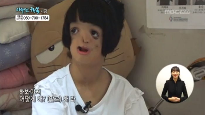 ‘안면 기형’ 앓아 귀 없이 뒤틀린 얼굴로도 웃음 잃지 않는 10살 소녀