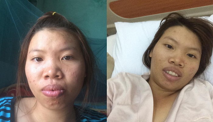 ‘못생겼다’며 남편에게 무시당하고 살던 여성은 ‘성형 수술’ 후 재벌 남친을 만났다