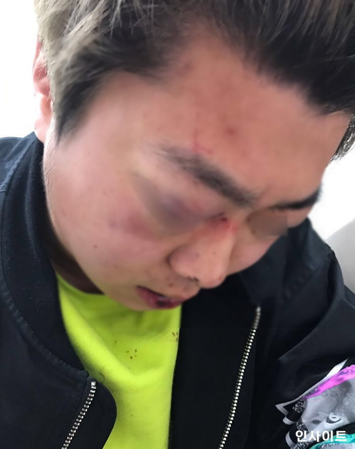 [단독] 고등학생 6명만 수사 받고 있는 ‘대구 집단 폭행 사건’ 당시 CCTV 영상