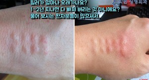 준성형외과 이미지