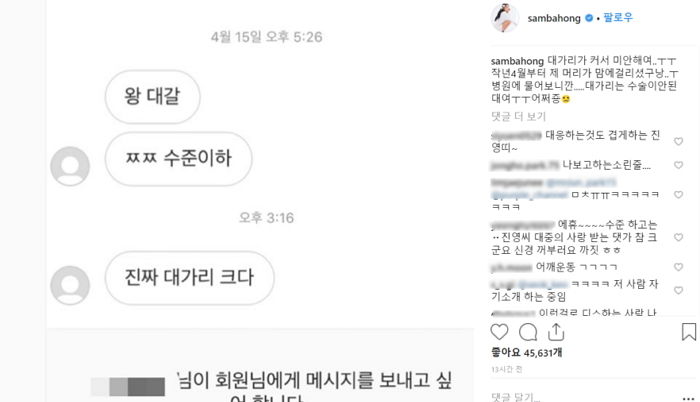 “미안해여ㅜㅜ” 본인 외모 비하 악플에 ‘사과글’ 올린 홍진영