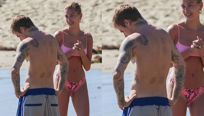 헤일리랑 바닷가 놀러가 ‘부항 자국’ 자랑한 저스틴 비버