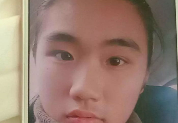 치료 부작용으로 얼굴에 난 ‘콧수염’ 보며 매일 이불 뒤집어쓰고 우는 13살 소녀