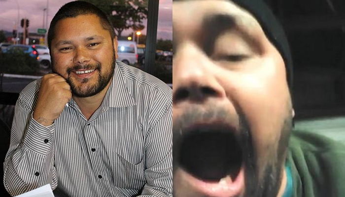 치과 가는 돈 아껴 자식 간식 사주려고 사랑니 ‘전기드릴’로 갈아낸 아빠
