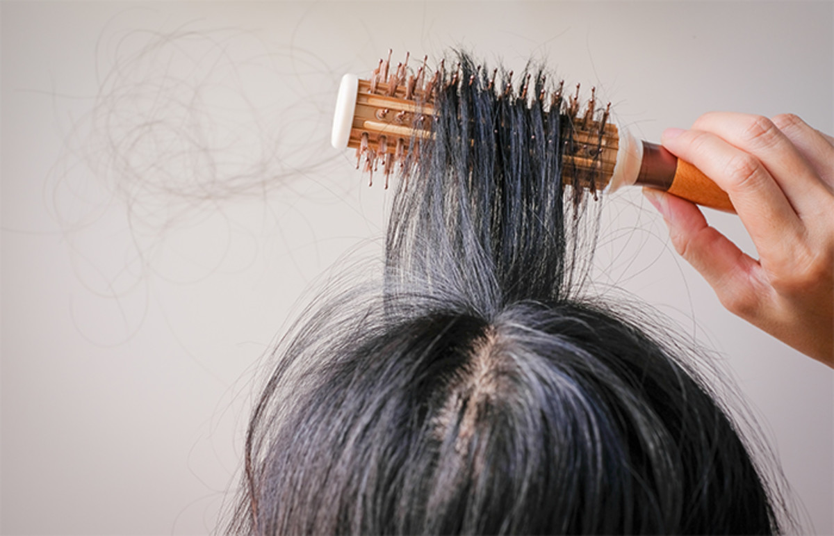 “설마 나도?” 무심코 지나칠 수 있는 탈모 증상 4가지